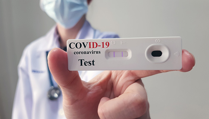PCR test in Serbia for foreign travelers | Learn how to get tested if you are in Serbia